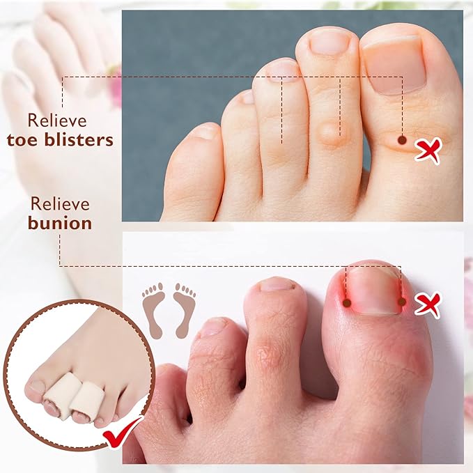 Tondiamo 6 Pieces Foam Toe Protector Sleeves Foam Bandages Tube Toe Cushion for Feet, Bunion, Hammer, Callus Corn, Bliste, Pain Relief(Medium,Beige)